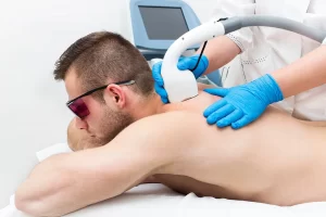 Лазерная эпиляция для мужчин: за и против